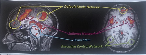 Brain scan and learning networks