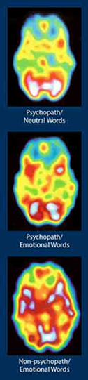 Brain scans