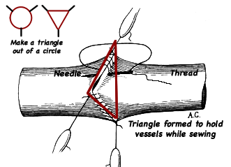 Suture technique