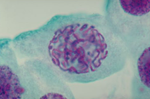 Cell in prophase