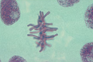Cell in metaphase